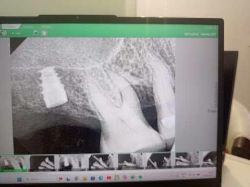 Photo from customer review