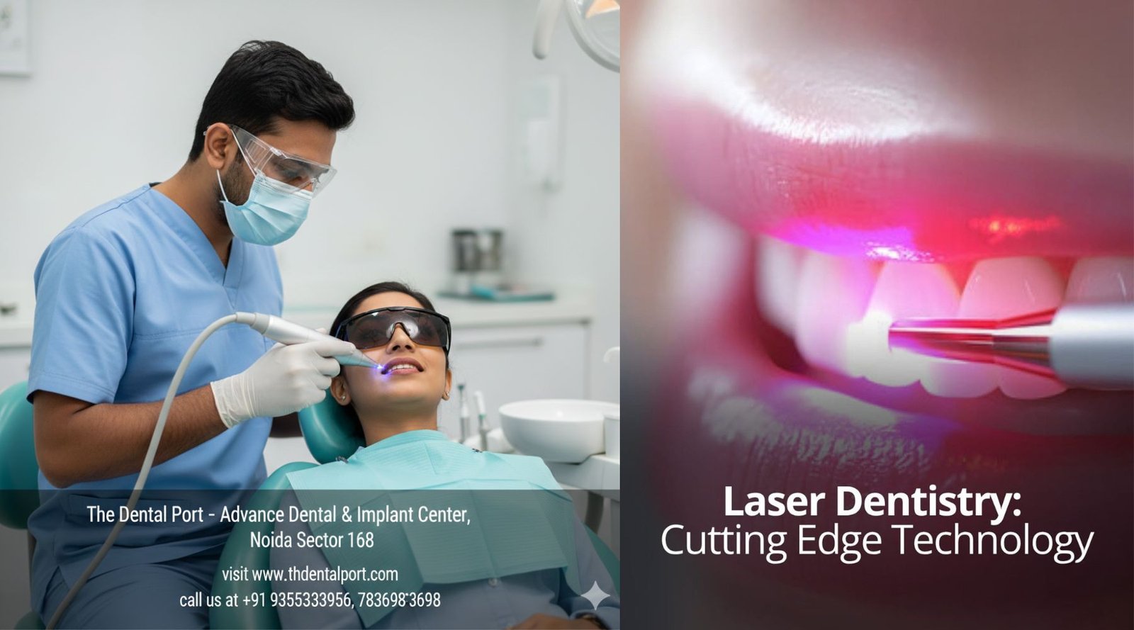 Laser dentistry at the dental port