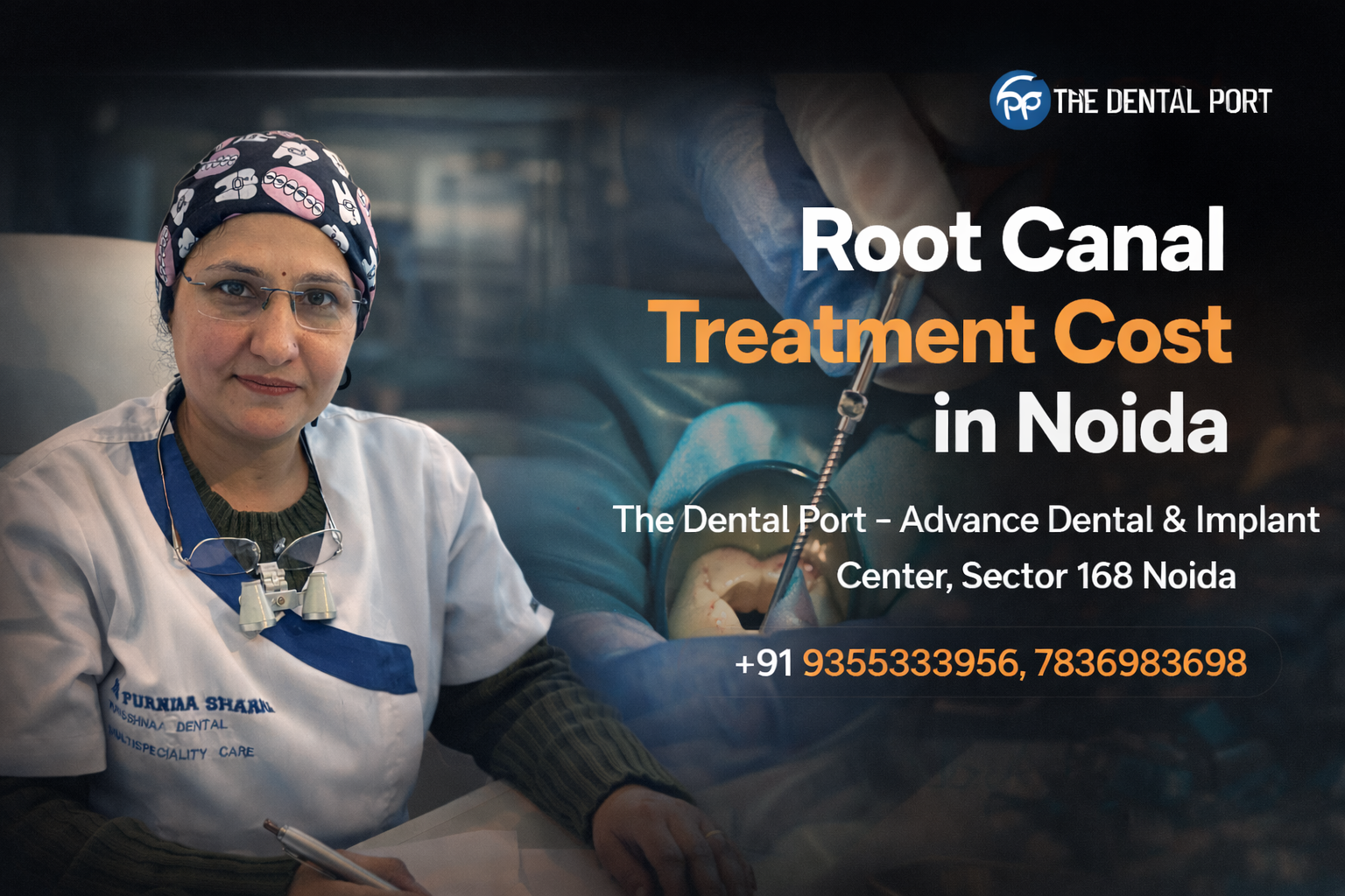 Root Canal Treatment Cost in Noida