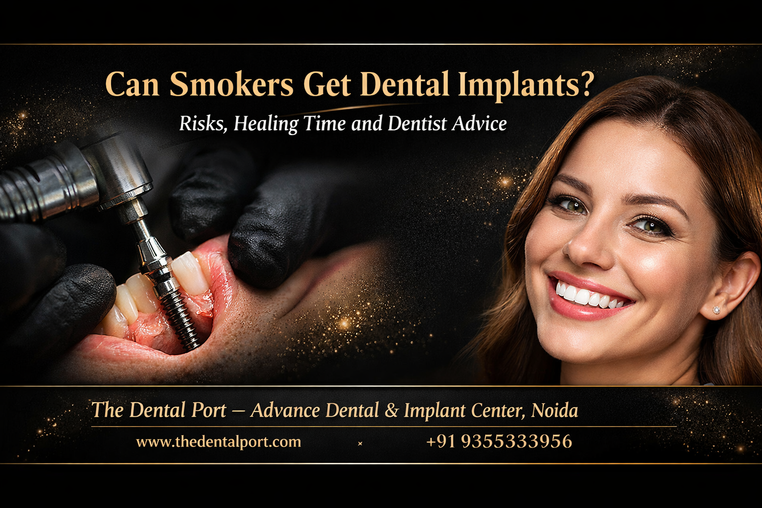 Can Smokers Get Dental Implants? Risks, Healing Time and Expert Advice at THE DENTAL PORT NOIDA