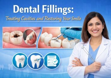 Dental Fillings in Noida