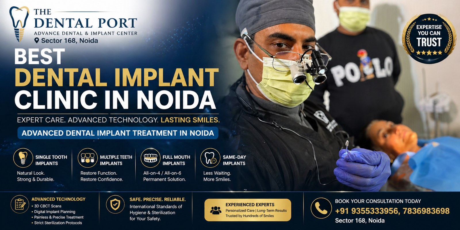 Best Dental Implant Clinic in Noida – What You Should Know Before Choosing