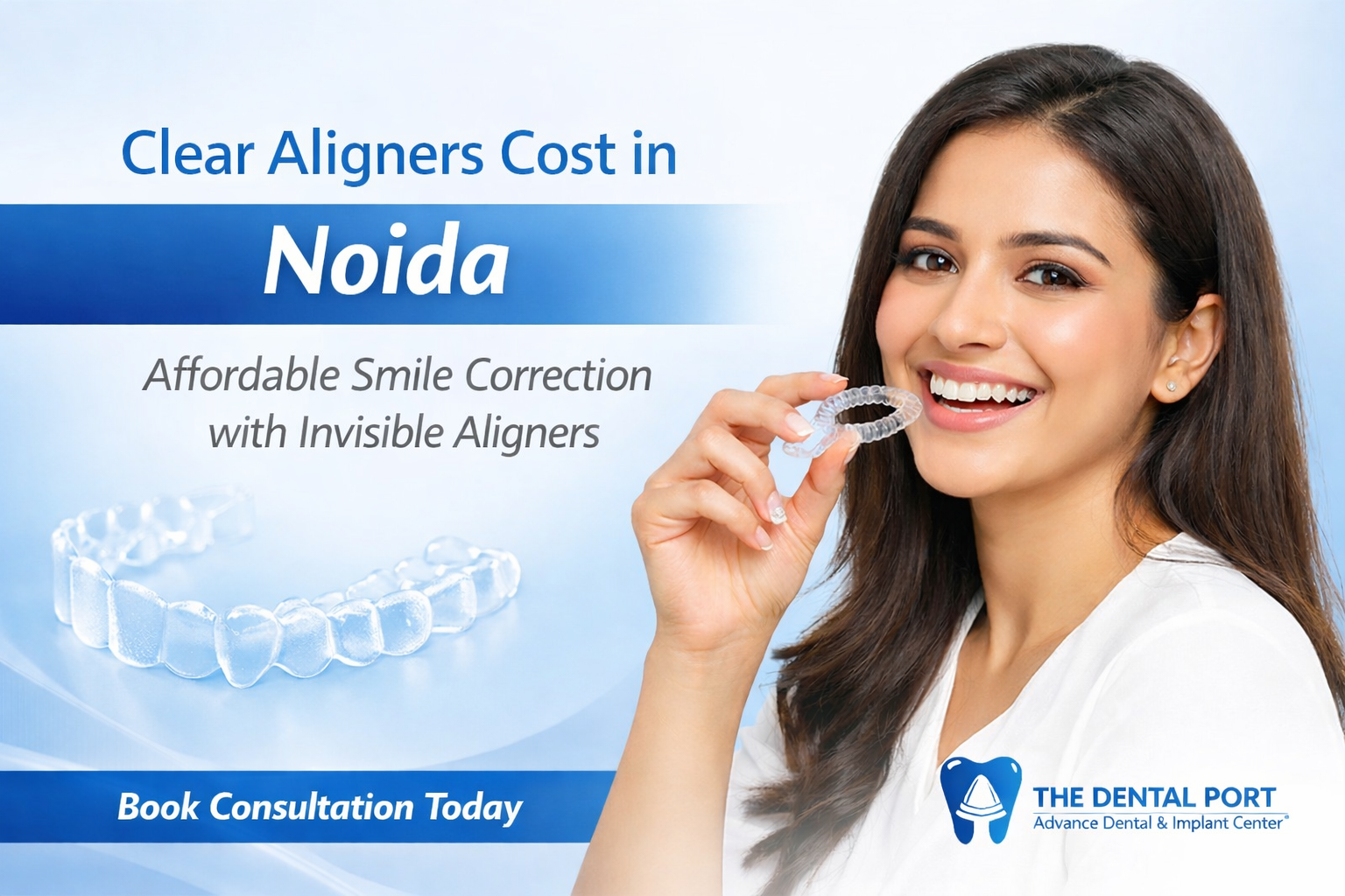 Clear Aligners Cost in Noida (2026): What You Should Know Before Starting Treatment