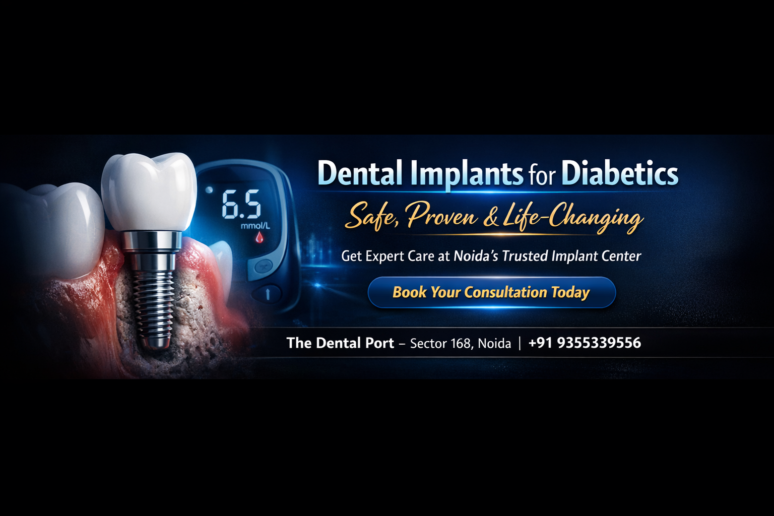Are Dental Implants Safe for Diabetic Patients? | The Dental  Port -Advance Dental & Implant Center Noida