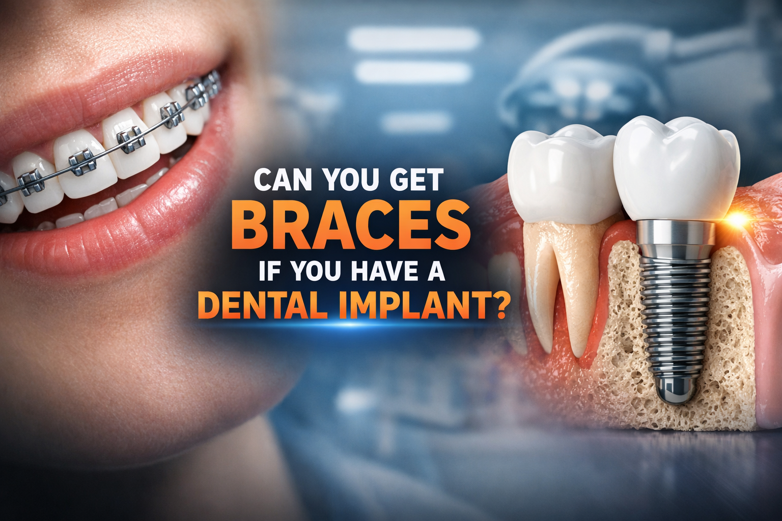 Can You Get Braces if You Have a Dental Implant?