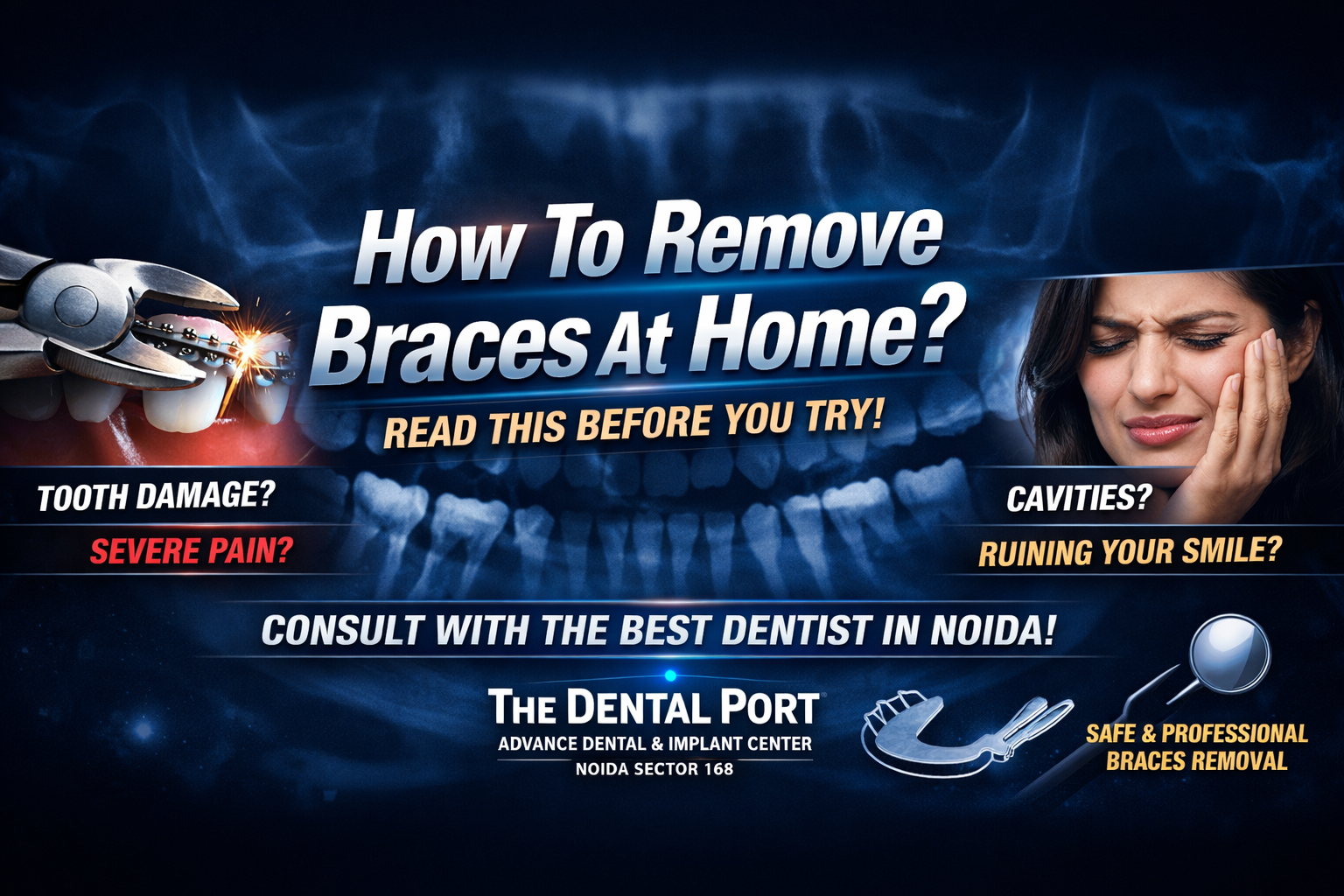 How To Remove Braces At Home? Read This Before You Try