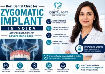 Best Dental Clinic for Zygomatic Implant in Noida
