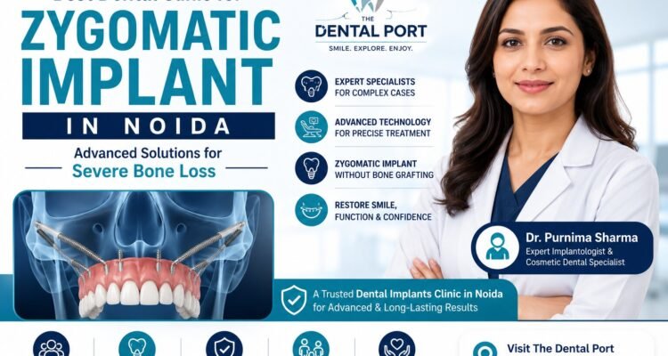 Best Dental Clinic for Zygomatic Implant in Noida