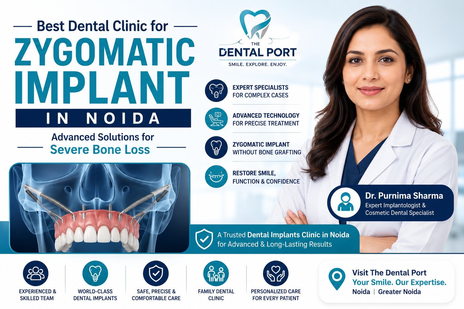 Best Dental Clinic for Zygomatic Implant in Noida