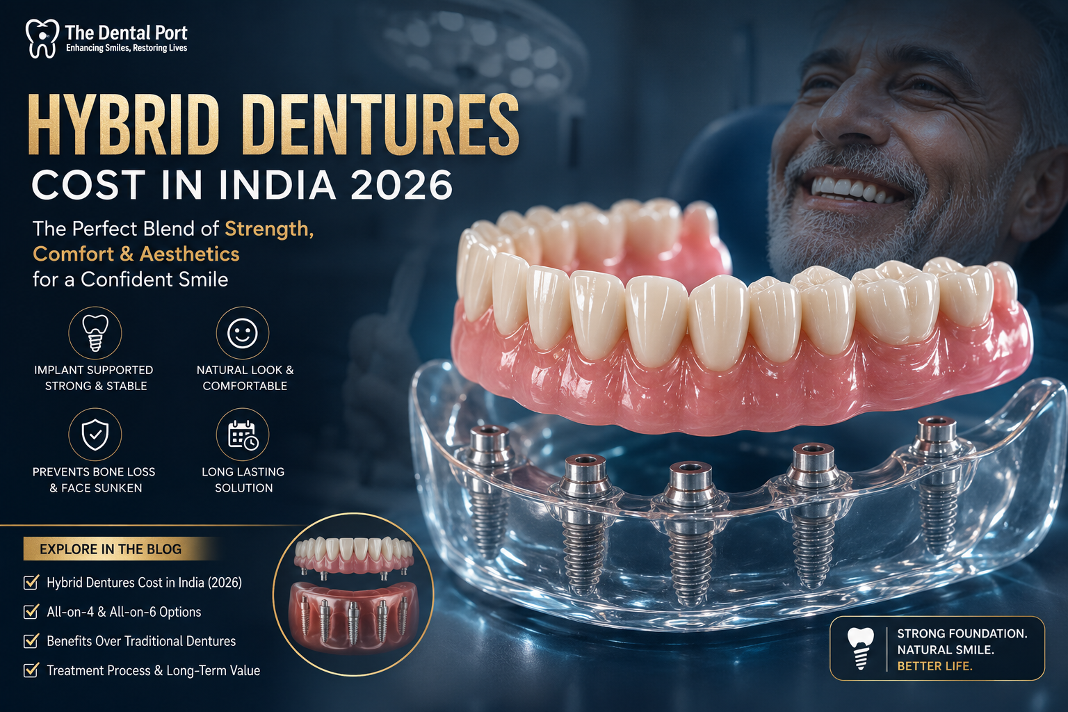 Hybrid Dentures (False Teeth) Cost in India: Complete Guide for 2026