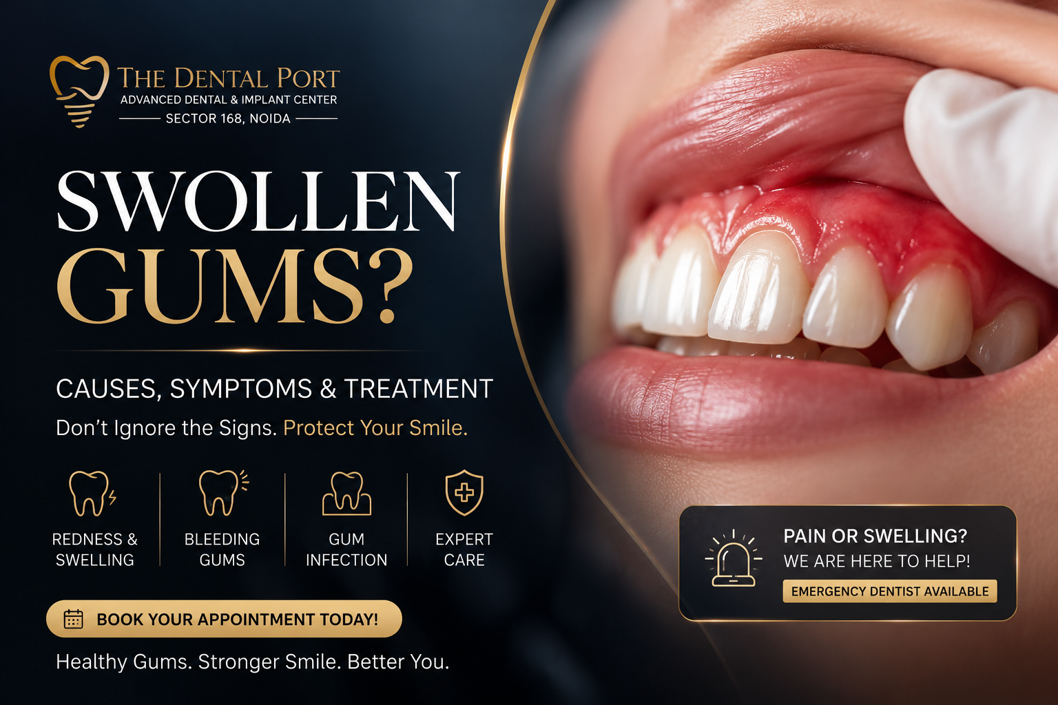 Swollen Gums: Causes, Symptoms, and Treatment | Expert Gum Care in Noida