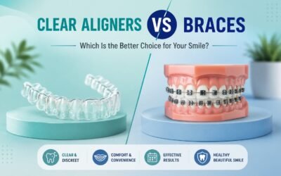 Clear Aligners in Noida