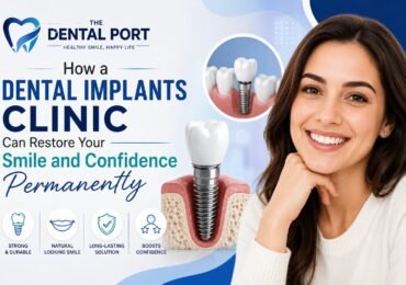 Best Dental Implants Clinic in Noida