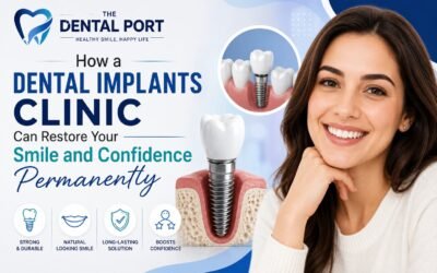 Best Dental Implants Clinic in Noida
