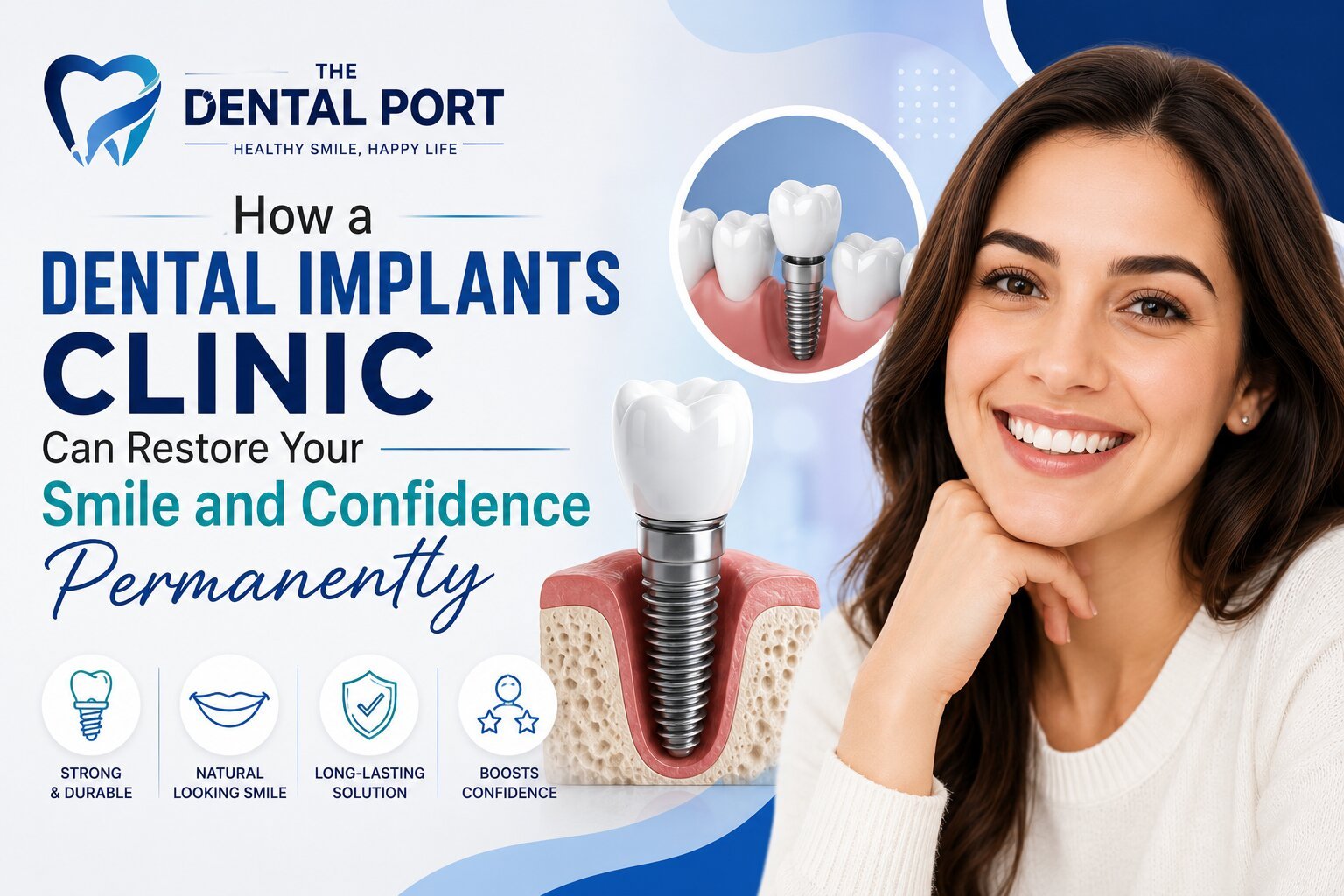 Best Dental Implants Clinic in Noida