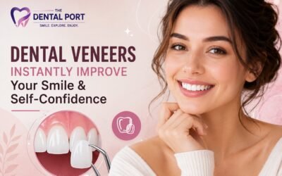Dental Veneers in Noida