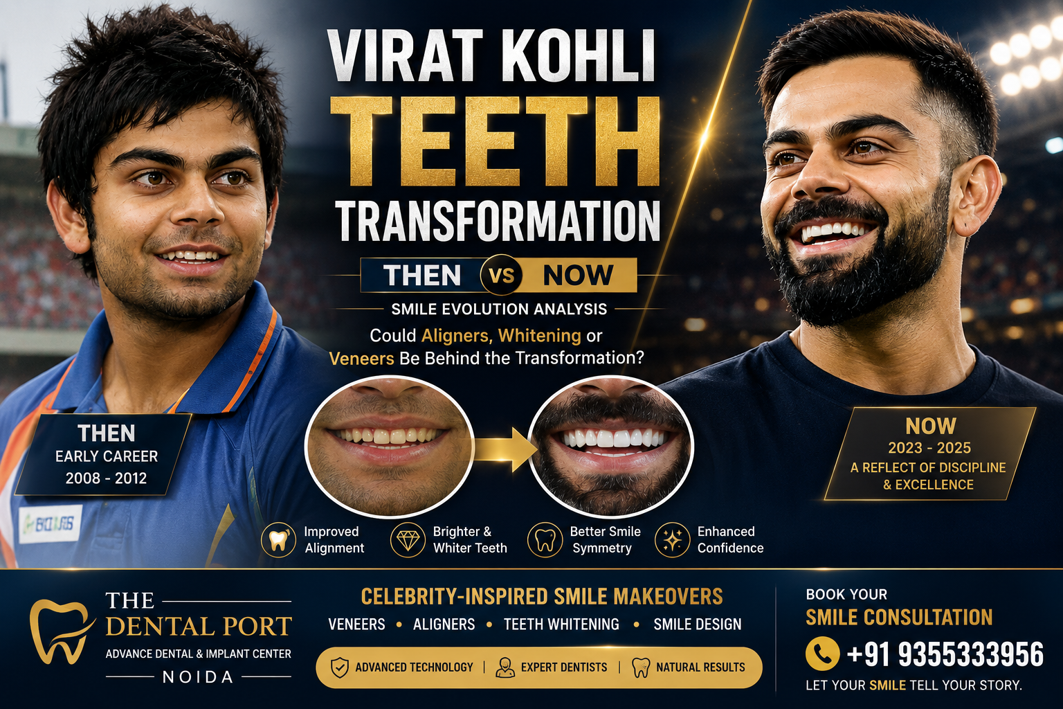 Virat Kohli Teeth Transformation: What Changed in His Smile? A Dentist’s Expert Analysis