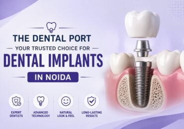 Trusted Dental Implant Clinic in Greater Noida