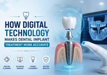Dental Implant Clinic in Noida