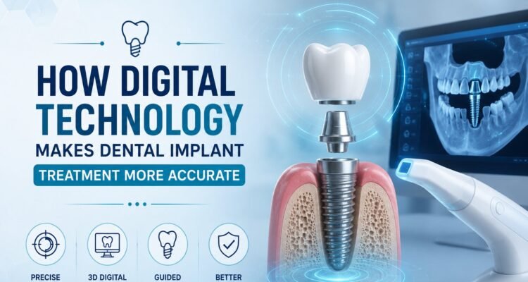 Dental Implant Clinic in Noida