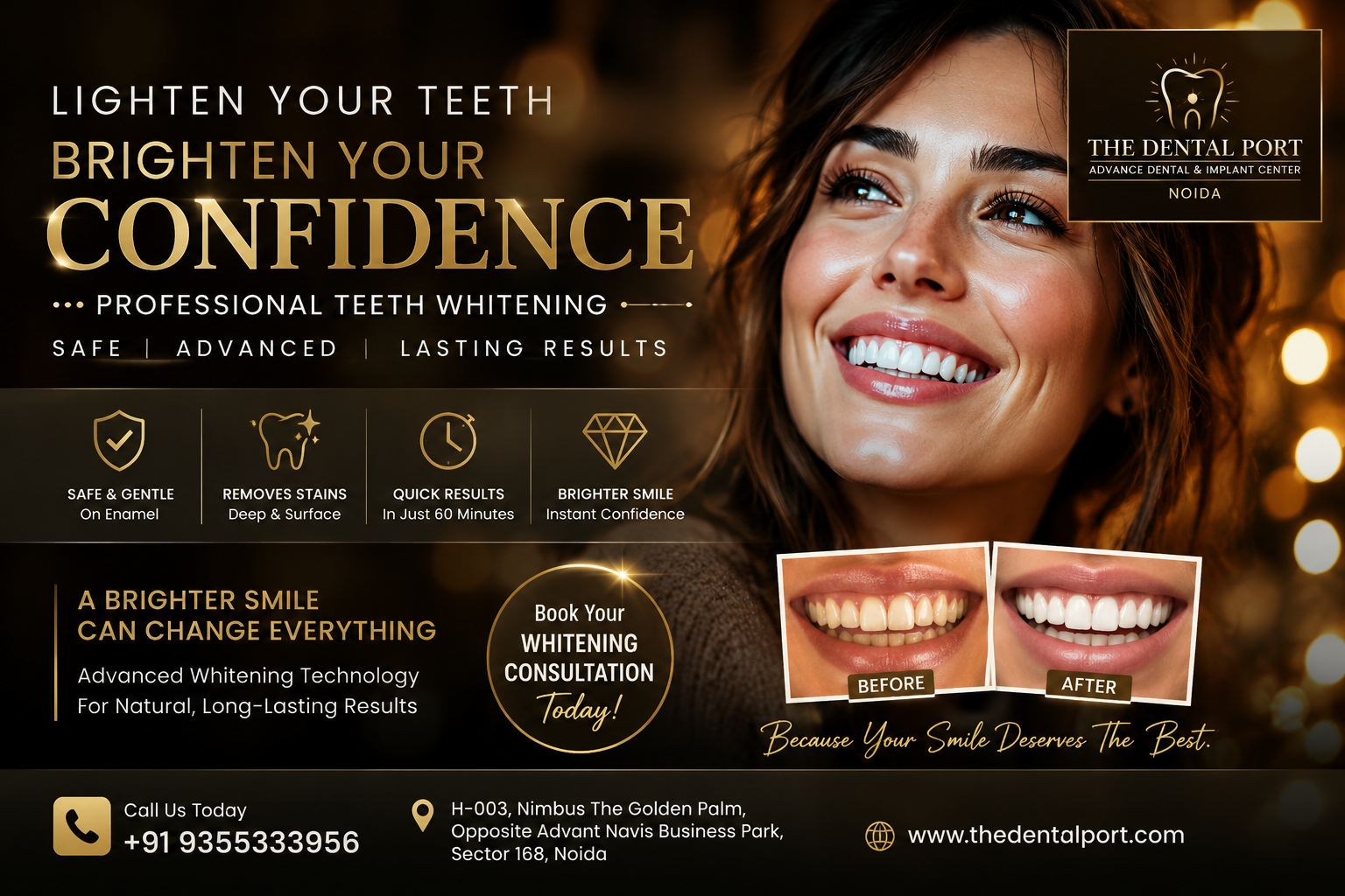 What to Consider Before Getting a Teeth Whitening Treatment? Everything You Should Know Before Whitening Your Smile