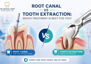 Root Canal vs Tooth Extraction