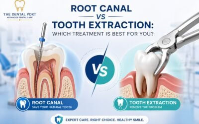 Root Canal vs Tooth Extraction