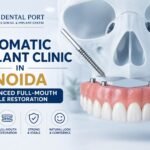 Zygomatic Implant Clinic in Noida
