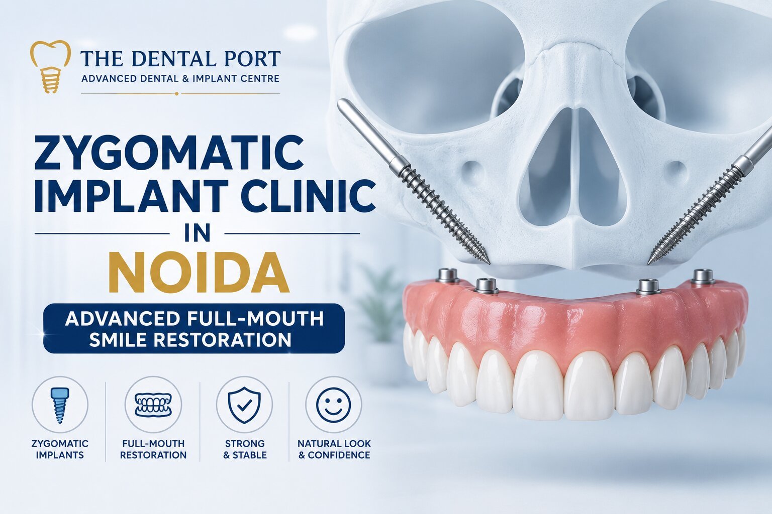 Zygomatic Implant Clinic in Noida
