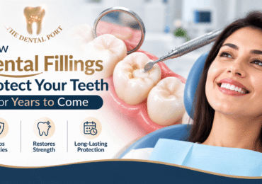 Dental Fillings in Noida