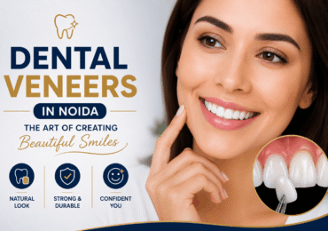 Dental Veneers in Noida