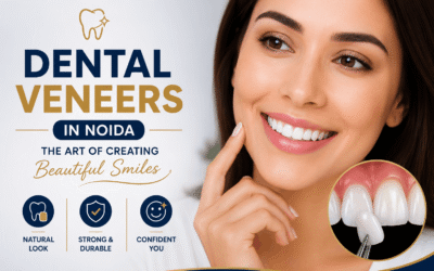 Dental Veneers in Noida