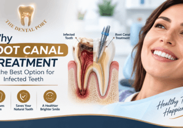 Best Root Canal Treatment in Noida