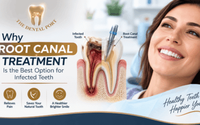 Best Root Canal Treatment in Noida