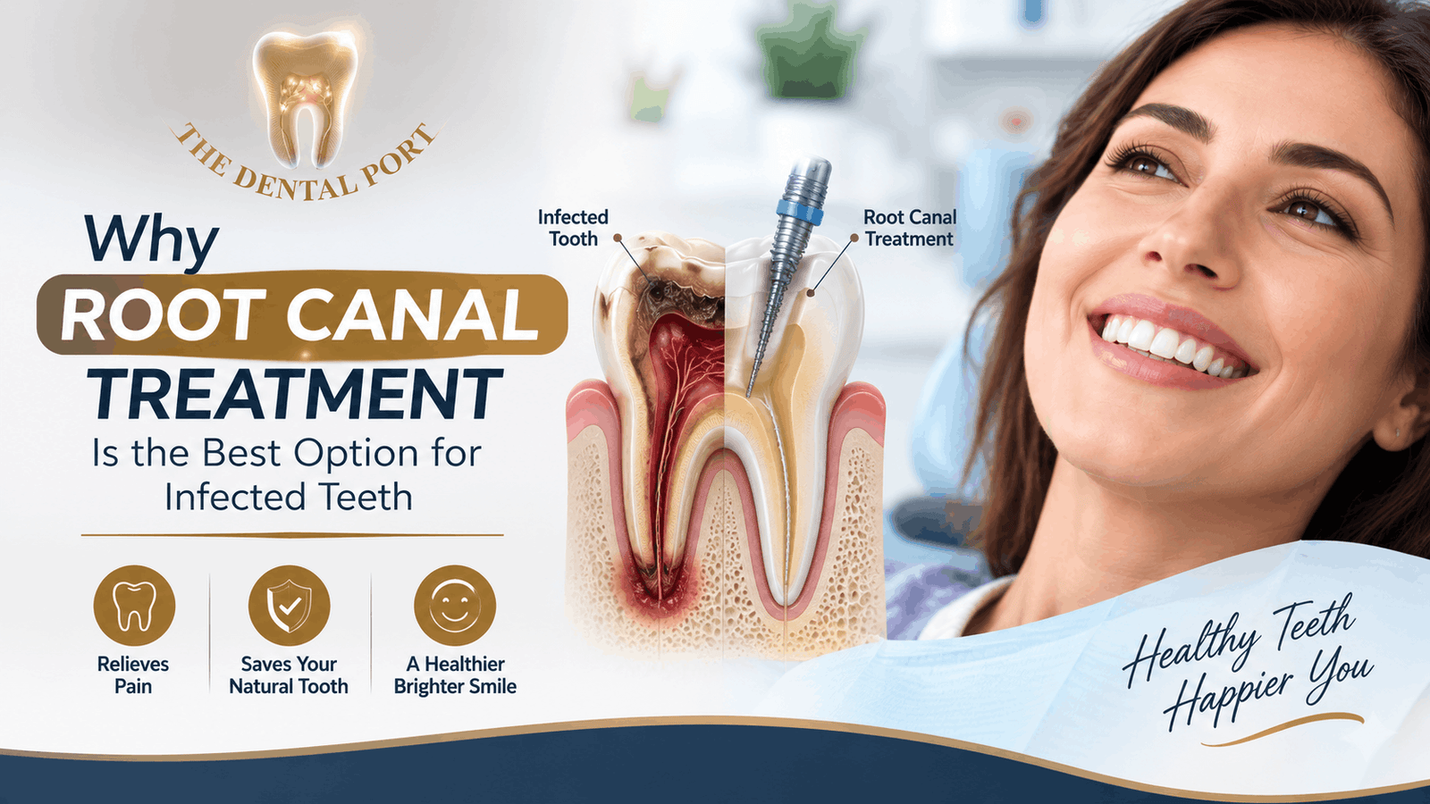 Best Root Canal Treatment in Noida
