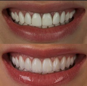 The Dental Port-(Advanced Dental & Implant Centre – Sector 168, Noida) place picture