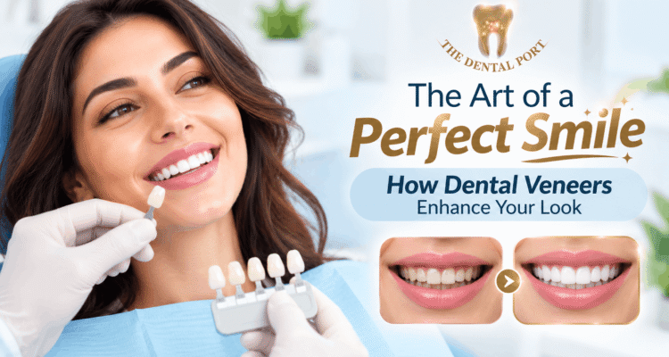 The Dental Port for dental veneers