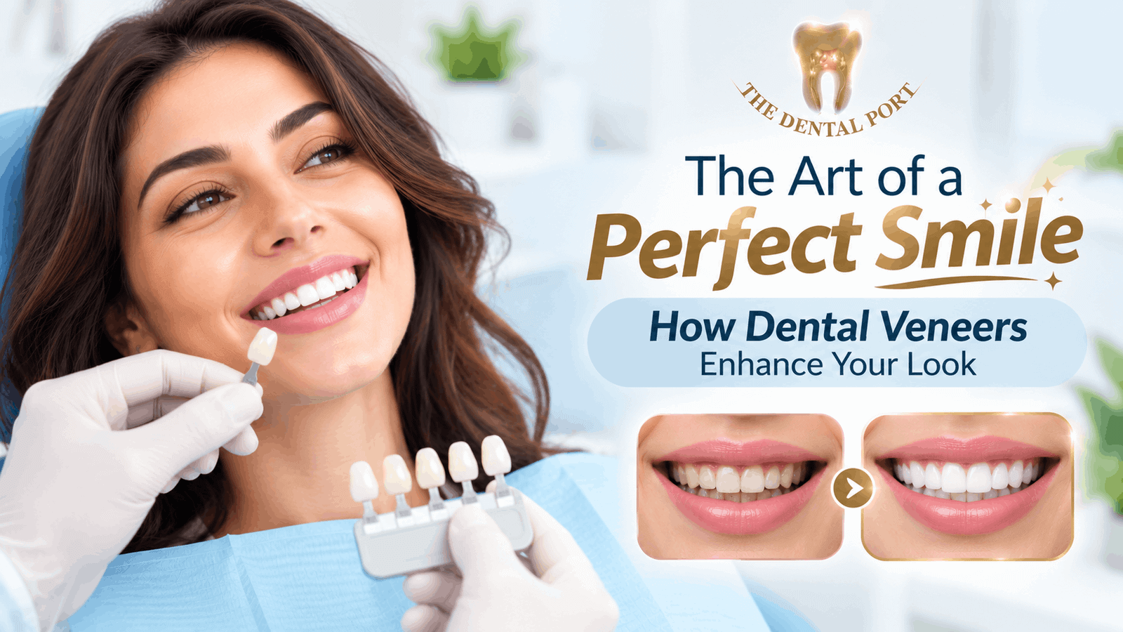 The Dental Port for dental veneers