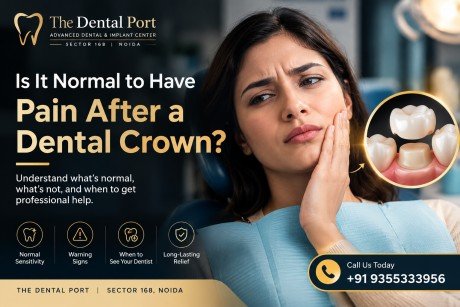 Is It Normal to Have Pain After a Dental Crown? A Dentist Explains What’s Normal and What Needs Attention