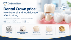 Dental Crown Cost in Noida: Zirconia, E-Max, PFM Crown Prices and Treatment Guide